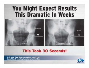 You might expect results this dramatic in weeks - this took 30 seconds!